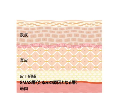 SMAS層（たるみの原因となる層）