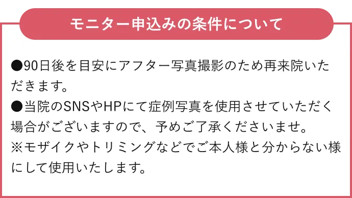 モニター申込みの場合の条件について