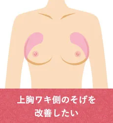 上胸ワキ側のそげを改善したい