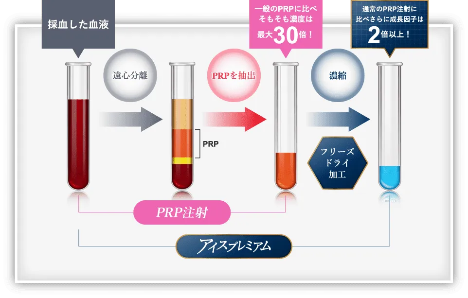 PRP注射とアイスプレミアムの作製の流れ