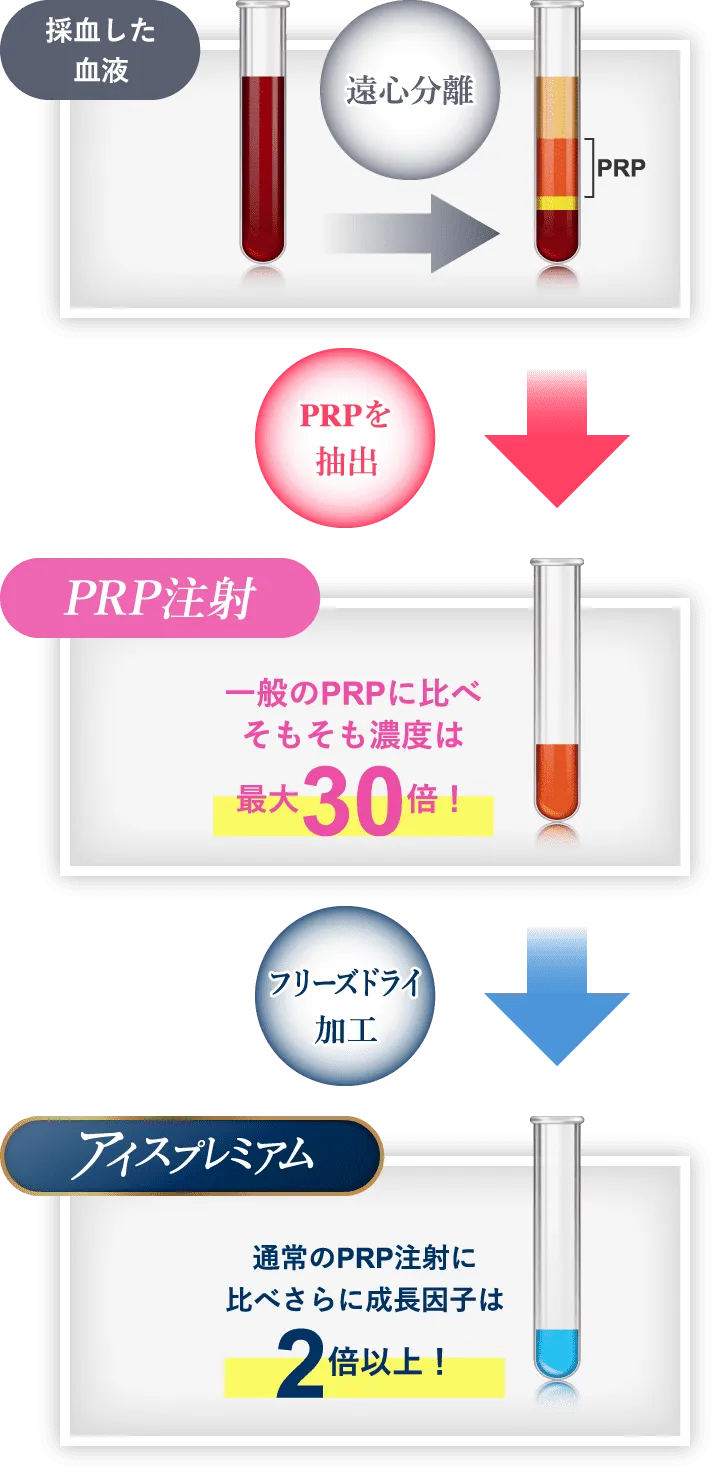 PRP注射とアイスプレミアムの作製の流れ