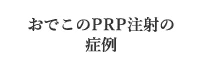 おでこPRP注射の症例