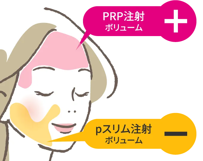 PRP注射施術部位：額、こめかみ