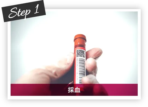 Step1 採血