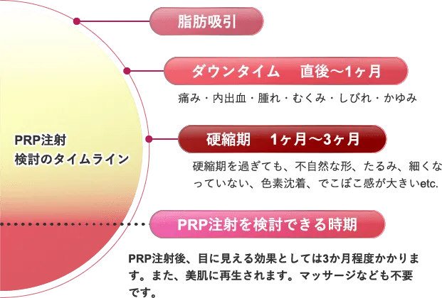 PRP注射検討のタイムライン