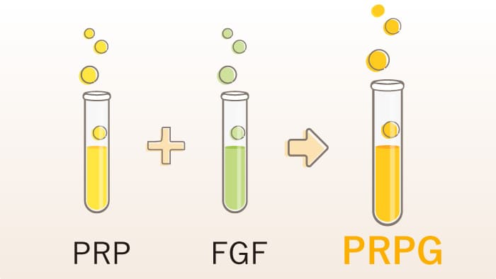 PRPとFGFの相乗効果