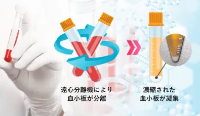 PRPがとにかく濃い!