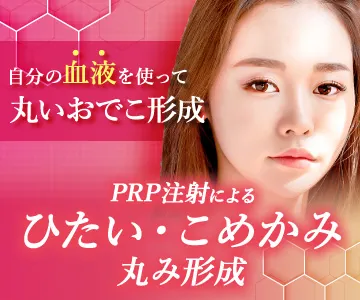 PRP注射によるひたい・こめかみ丸み形成