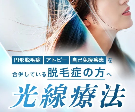 円形脱毛症・アトピー・自己免疫疾患を合併している脱毛症の方へ　光線療法