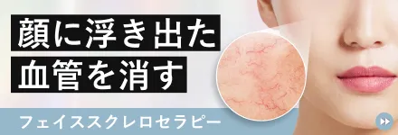 フェイススクレロセラピー（顔の硬化療法）